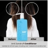 Generic Unisex Protein Anti Dandruff Conditioner (350 ML) Generic Unisex Protein Anti Dandruff Conditioner (350 ML)