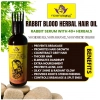 Generic Devi Herbels Rabbit Blood Herbal 100 ML Hair Oil - Men's And Women's Hair Growth Oil Generic Devi Herbels Rabbit Blood Herbal 100 ML Hair Oil - Men's And Women's Hair Growth Oil